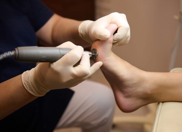 Close-up of a patient visiting podiatrist, on medical pedicure procedure, receiving hardware peeling procedure with electric machine Close-up of a patient on medical pedicure procedure, visiting podiatrist, receiving hardware peeling procedure with electric machine