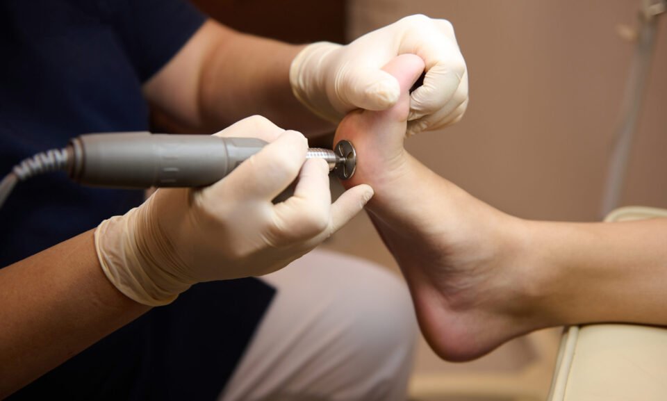 Close-up of a patient visiting podiatrist, on medical pedicure procedure, receiving hardware peeling procedure with electric machine Close-up of a patient on medical pedicure procedure, visiting podiatrist, receiving hardware peeling procedure with electric machine